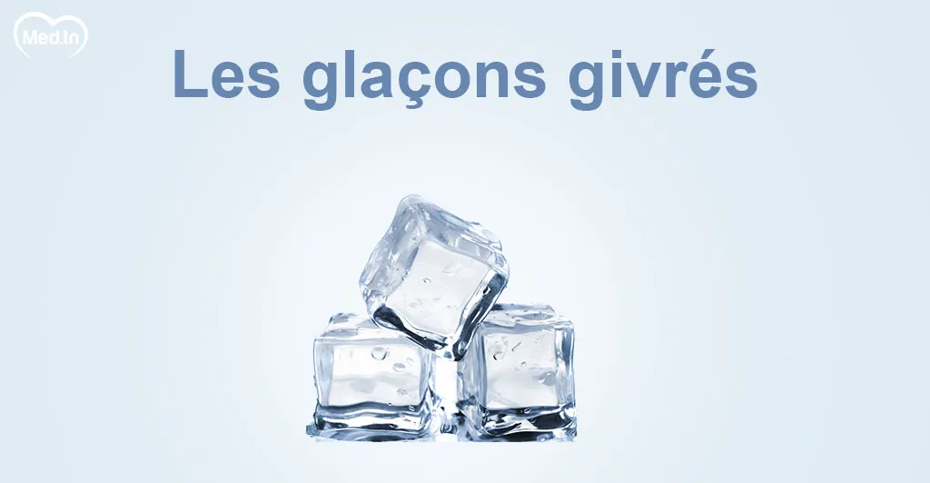 Top des astuces naturelles pour réduire ses cernes 